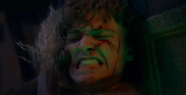 Le jeune Torbin, un personnage blessé et grimaçant de douleur, son visage marqué par des coupures et éclairé par la lumière verte d'un sabre laser.